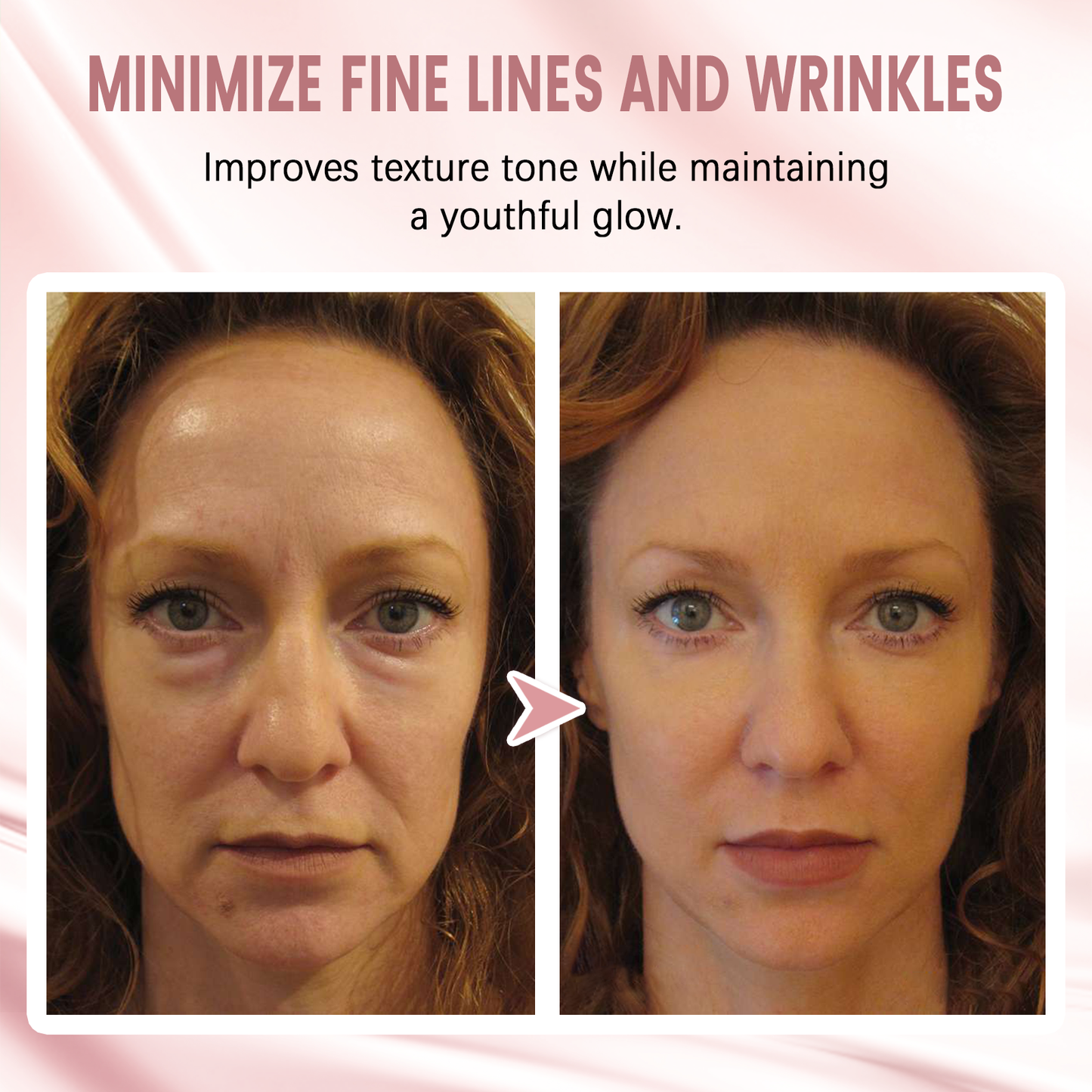 🎅 Early Xmas Sales 🎄 Last Day Discount: 87% OFF 🌸 Second Gen Instant Wrinkle Eraser 🌟