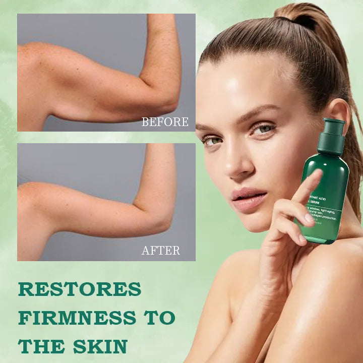 🔥🔥Last Day Promotion 𝟕𝟎%𝐎𝐅𝐅 - BBOJI™ SkinFirming Rejuvenating Serum🔥