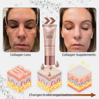 โจ๐๐๐ฌ๐ญ ๐๐๐ฒ ๐๐ข๐ฌ๐๐จ๐ฎ๐ง๐ญ: 87% ๐๐
๐
๐ธ Instant Wrinkle Eraser: Restore Skin Elasticityโญ