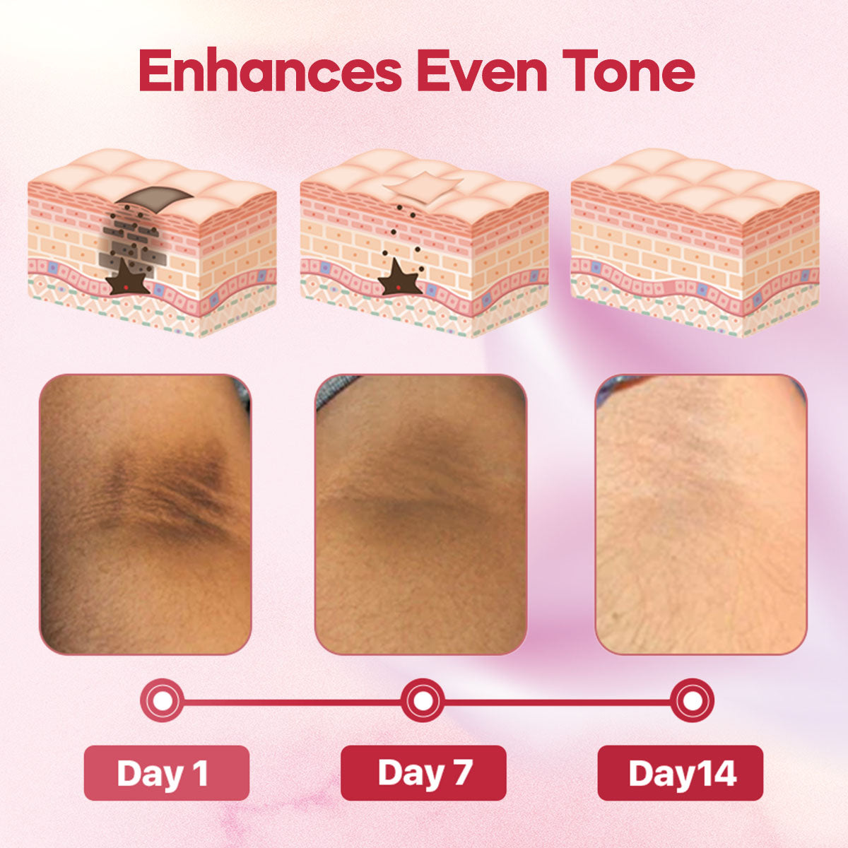 LOVILDS⢠Skin Whitening Cream š„ Last Day Sale Off 70%š„