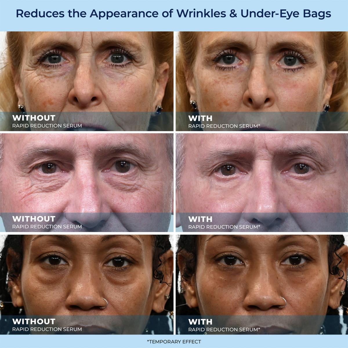 LOVILDS™ Rapid Reduction Wrinkle Serum