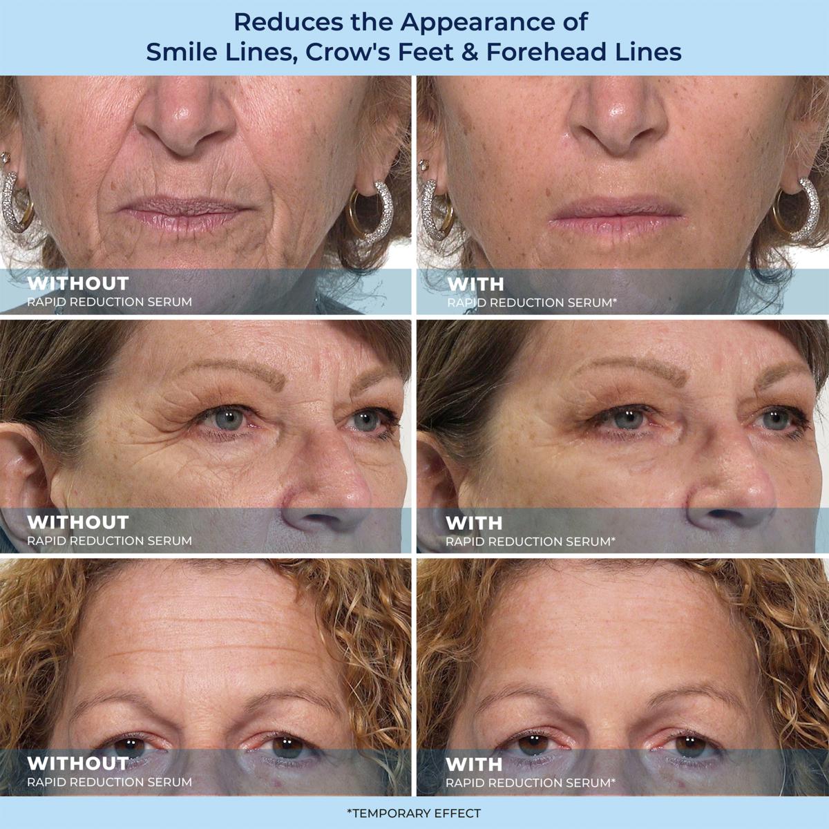 LOVILDS™ Rapid Reduction Wrinkle Serum