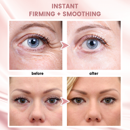 🎅 Early Xmas Sales 🎄 Last Day Discount: 87% OFF 🌸 Second Gen Instant Wrinkle Eraser 🌟