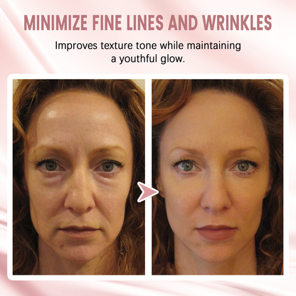 🎅 Early Xmas Sales 🎄 Last Day Discount: 87% OFF 🌸 Second Gen Instant Wrinkle Eraser 🌟