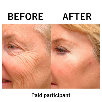 🔥🔥 Last Day Discount: 87% OFF 🌸Instant Temporary Face Tightener