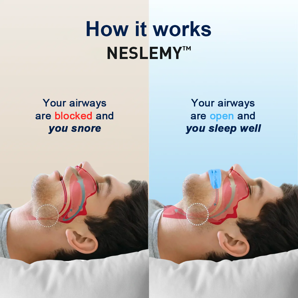 NESLEMY™  Professional intelligent anti-snoring device