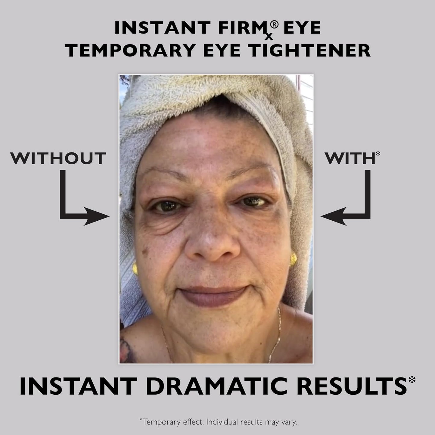 🔥🔥 Last Day Discount: 87% OFF 🌸Instant Temporary Face Tightener