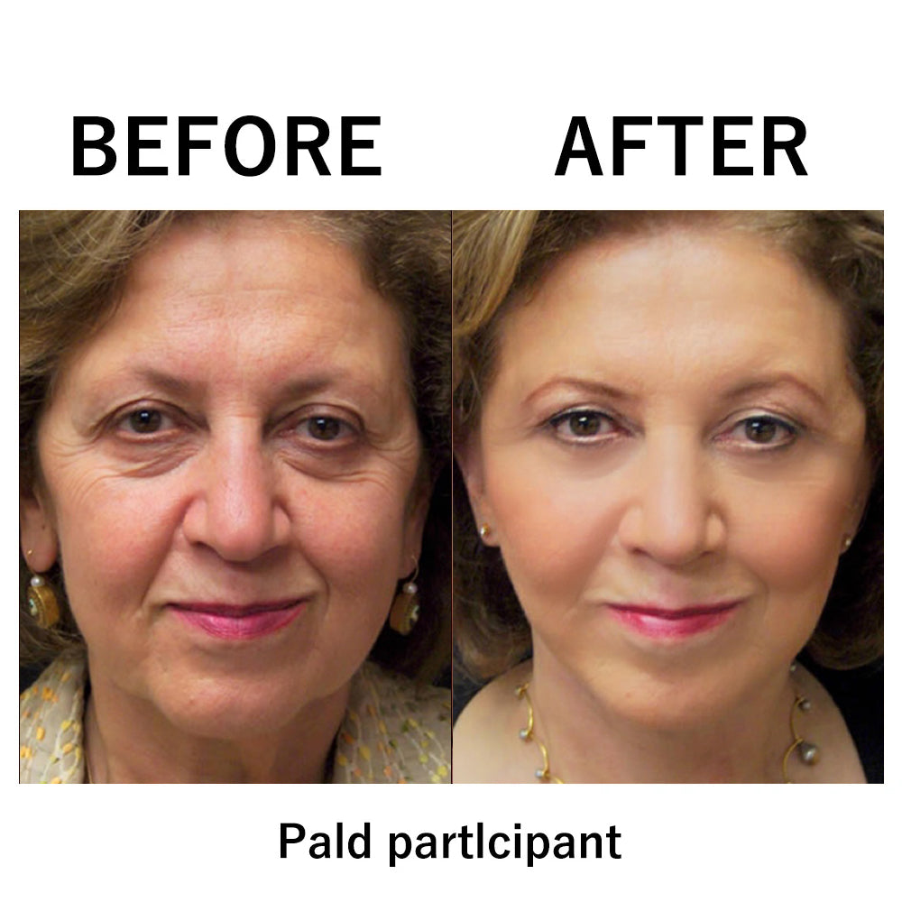 🔥🔥 Last Day Discount: 87% OFF 🌸Instant Temporary Face Tightener