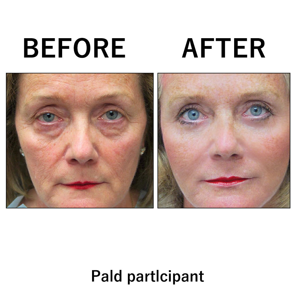 🔥🔥 Last Day Discount: 87% OFF 🌸Instant Temporary Face Tightener
