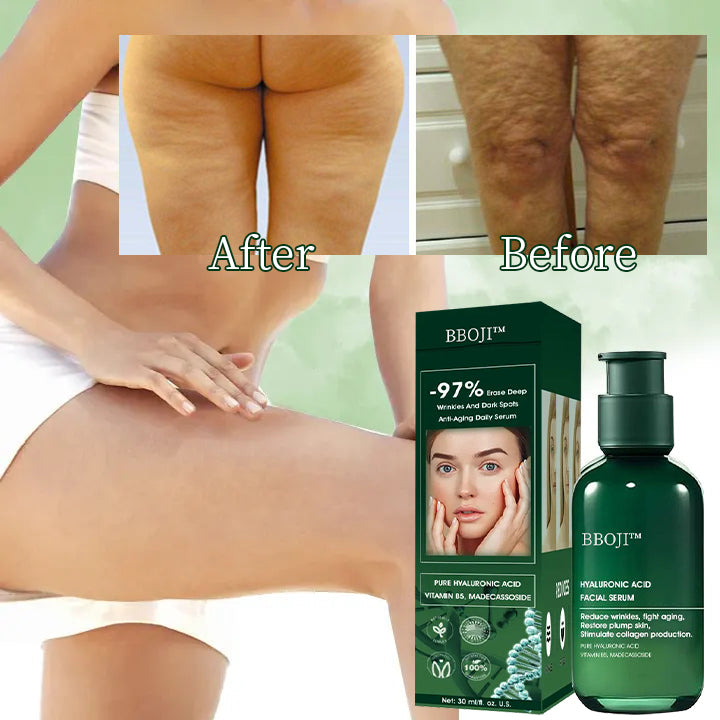 🔥🔥Last Day Promotion 𝟕𝟎%𝐎𝐅𝐅 - BBOJI™ SkinFirming Rejuvenating Serum🔥